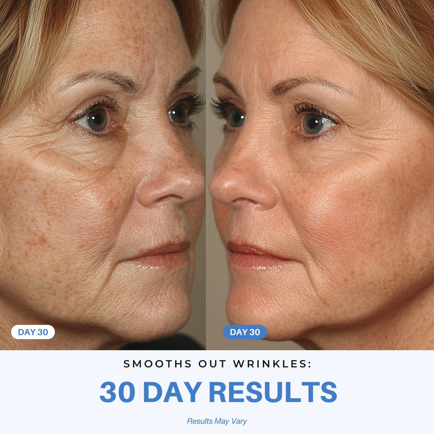 iAura 7-in-1 Radiant Pro Sculptor 30 Day Results Wrinkles
