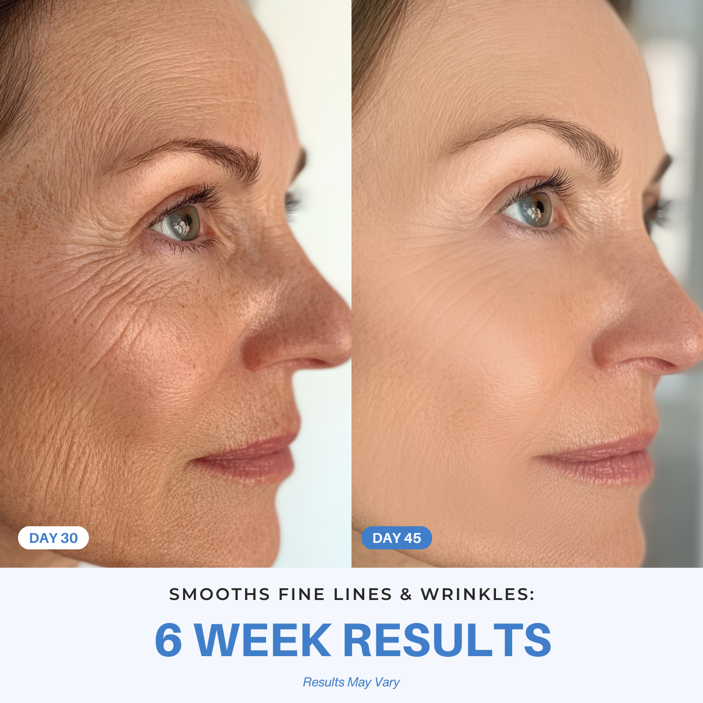iAura Sculptor 6 Week Results  Wrinkles